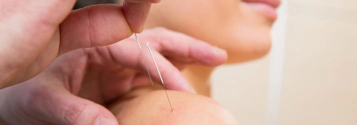 Chronic Pain Springfield VA acupuncture conditions