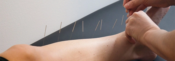 Chronic Pain Springfield VA acupuncture